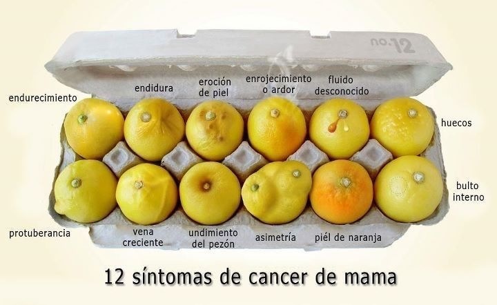 Diagnóstico cáncer mama en Sevilla